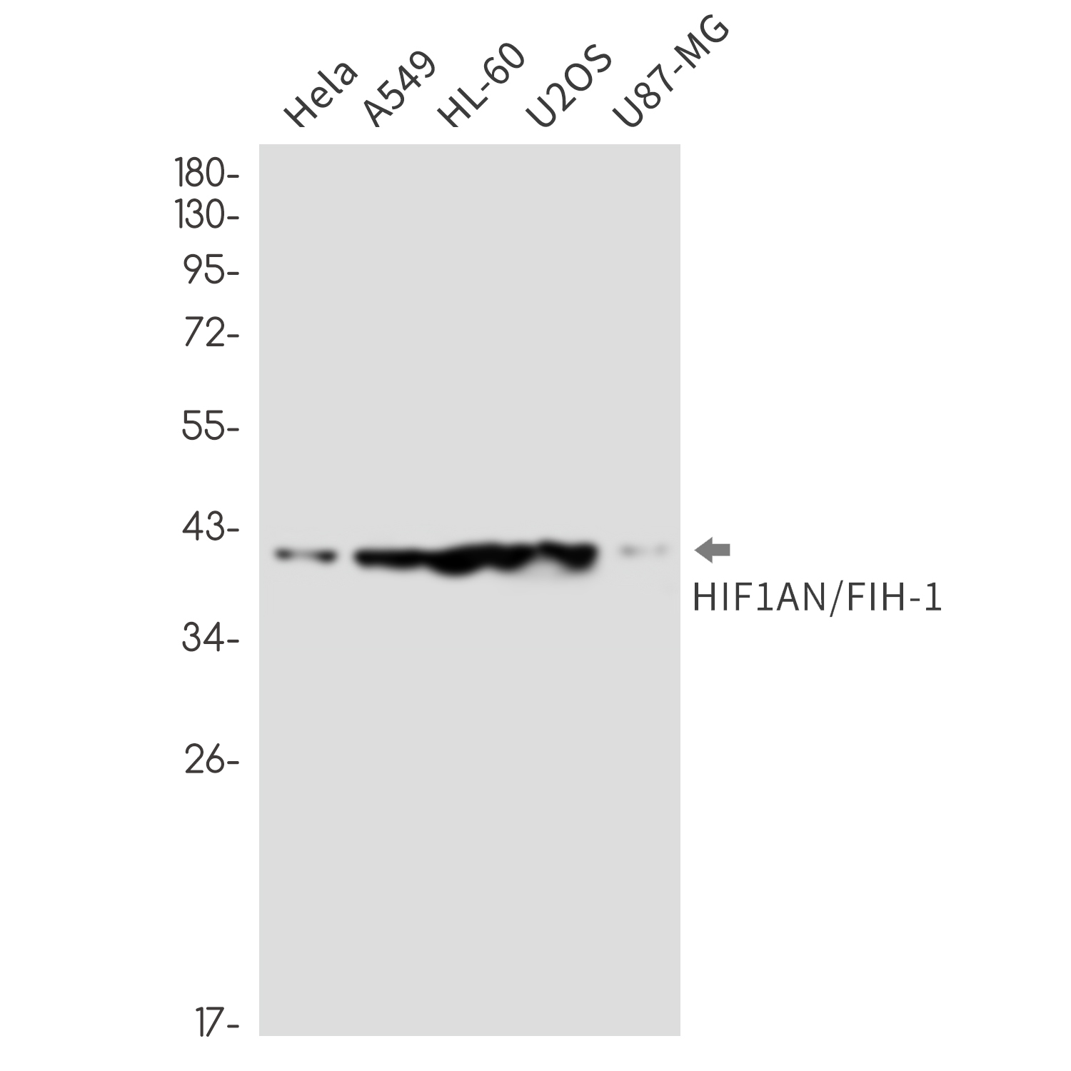 HIF1AN Rabbit mAb