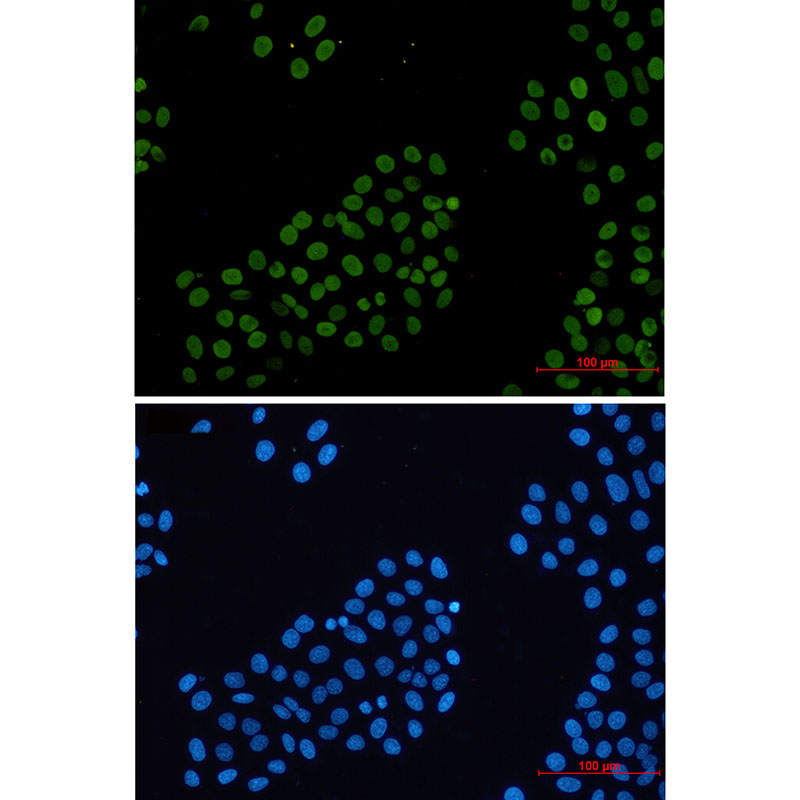 Histone H2A.X Rabbit mAb