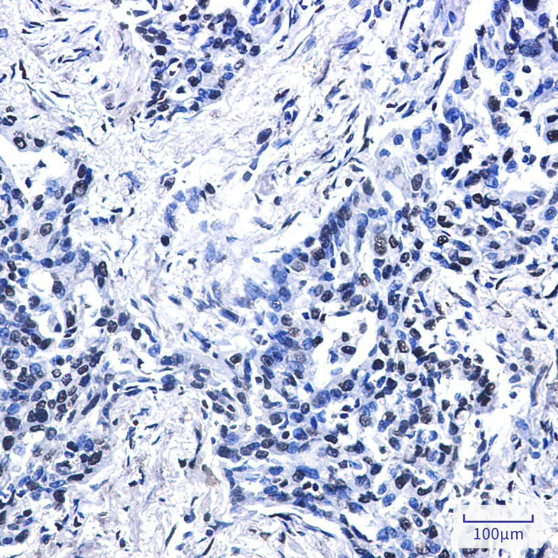 Histone H2A.X Rabbit mAb