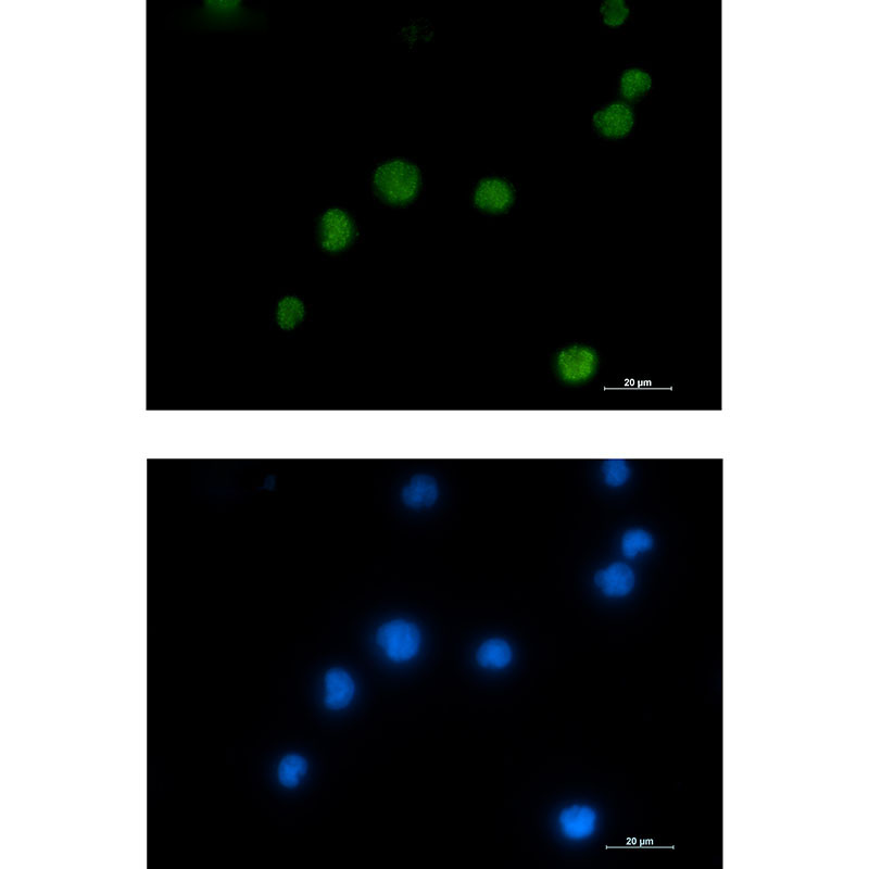 HMGB2 Rabbit mAb