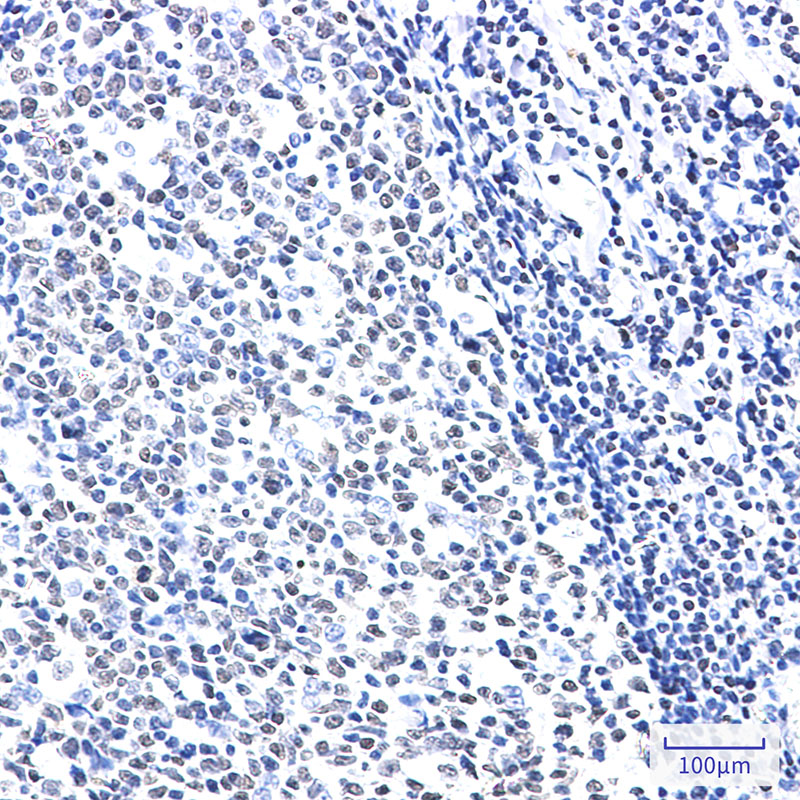 HMGB2 Rabbit mAb