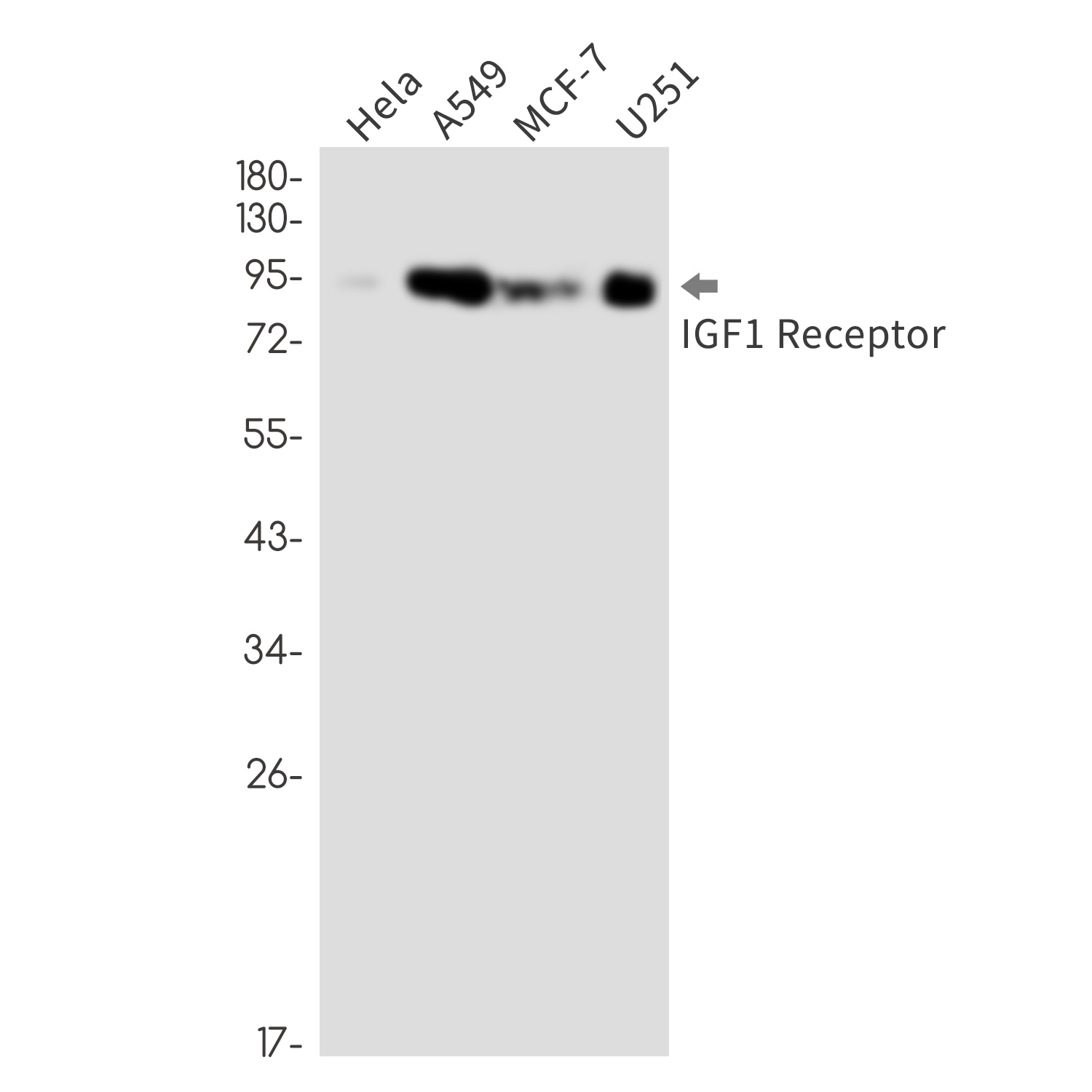 IGF1 Receptor Rabbit mAb