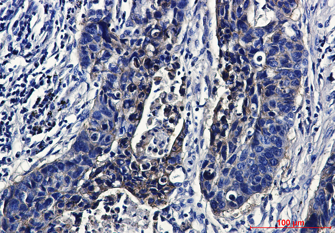 IGF1 Receptor Rabbit mAb