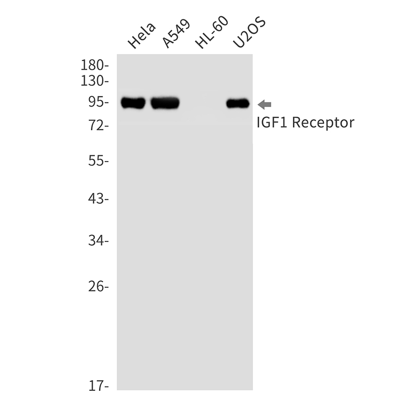 IGF1 Receptor Rabbit mAb