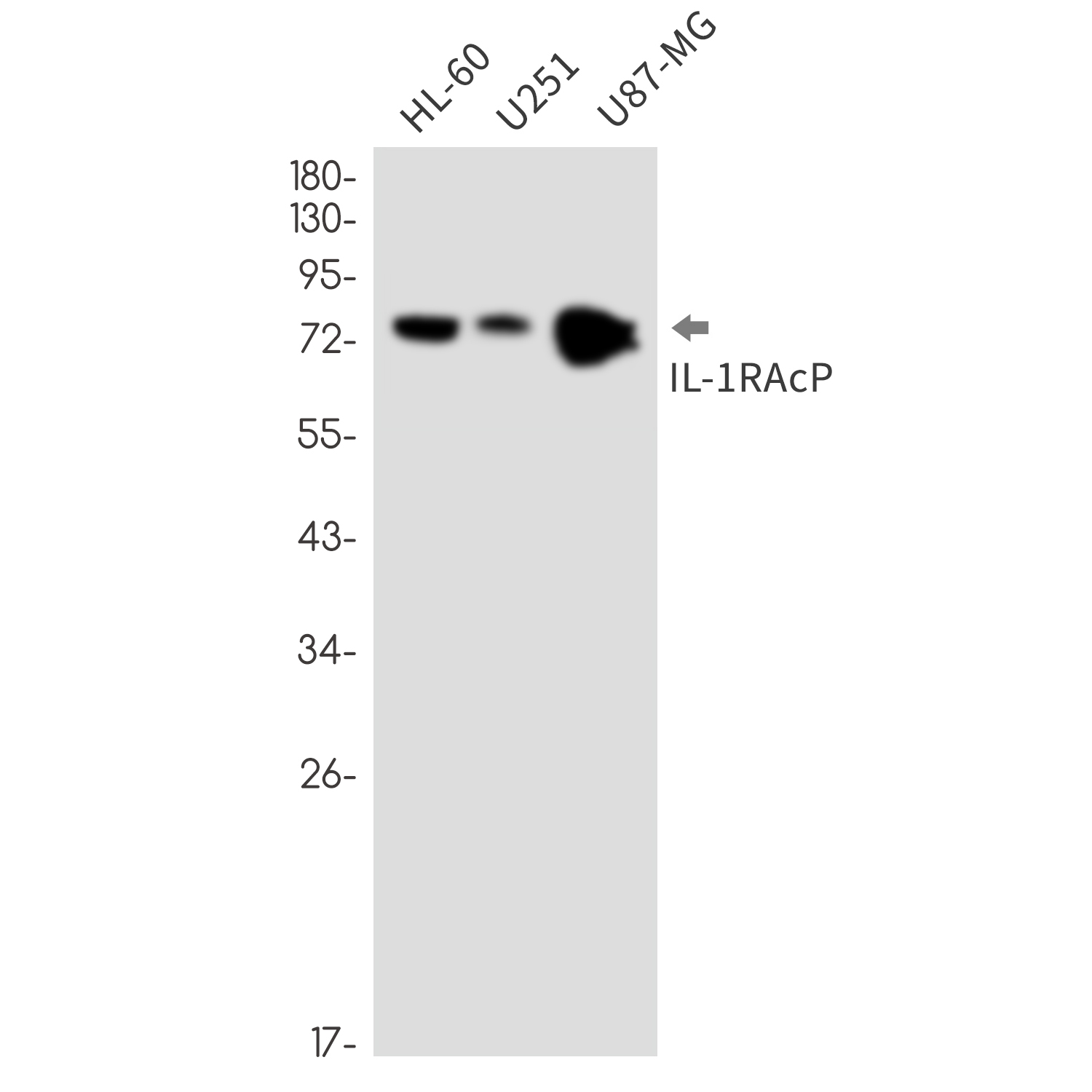 IL-1 Receptor Accessory Protein Rabbit mAb