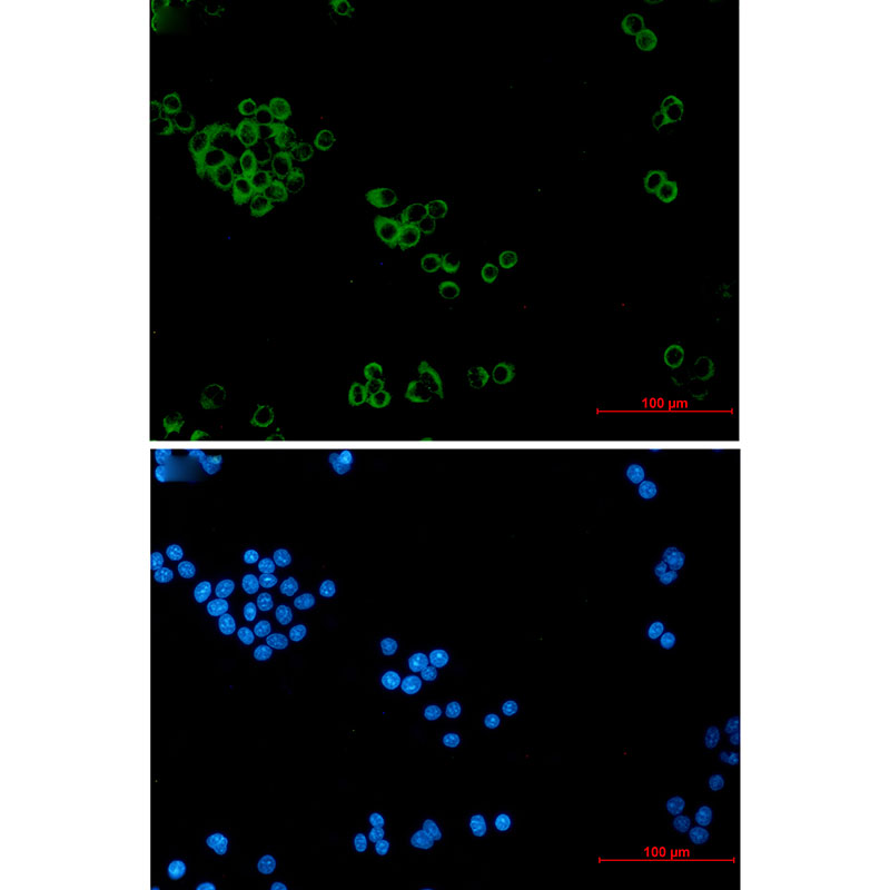 IMPDH2 Rabbit mAb