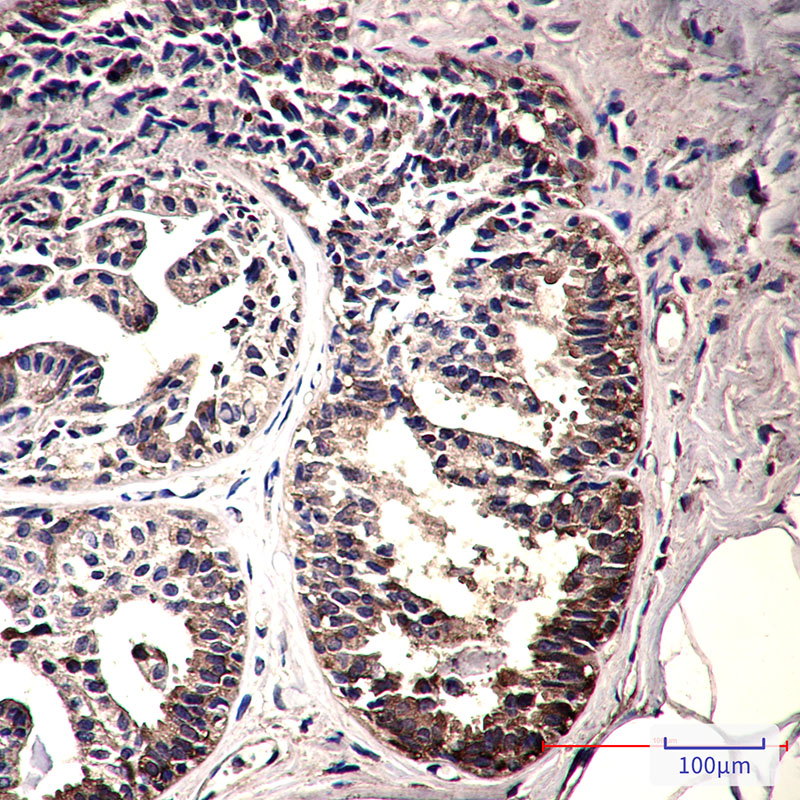 IMPDH2 Rabbit mAb