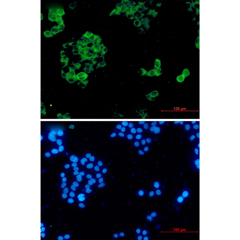 Insulin Degrading Enzyme Rabbit mAb