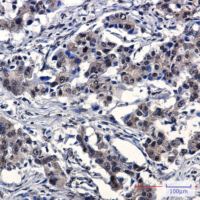 IRF3 Rabbit mAb