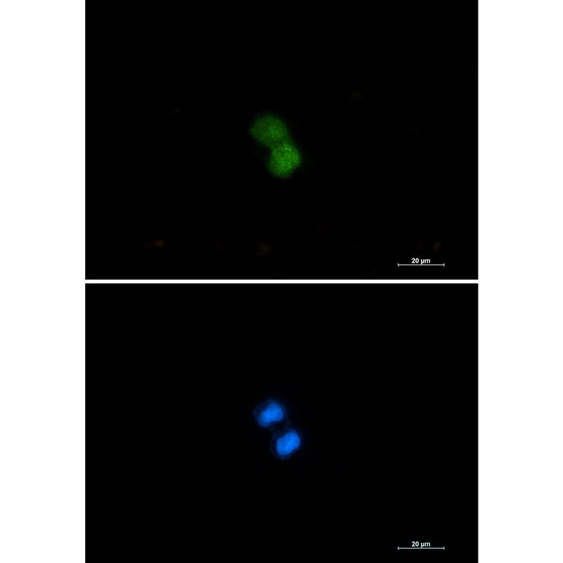 KAT7 Rabbit mAb