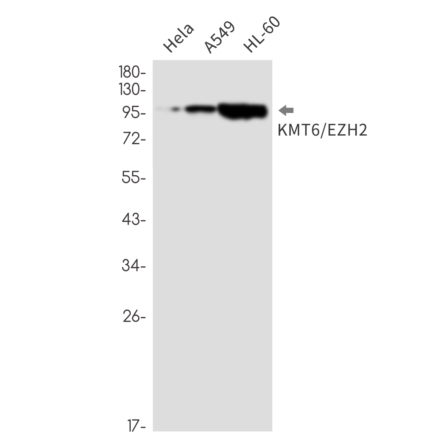 KMT6 Rabbit mAb