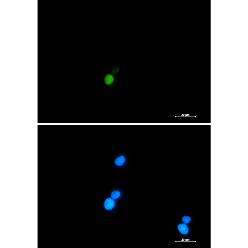 Ku70 Rabbit mAb