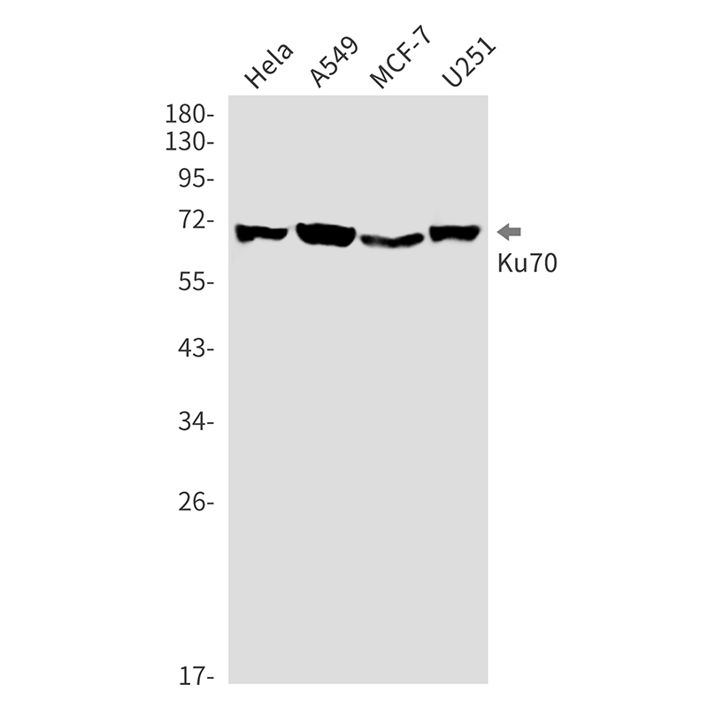 Ku70 Rabbit mAb