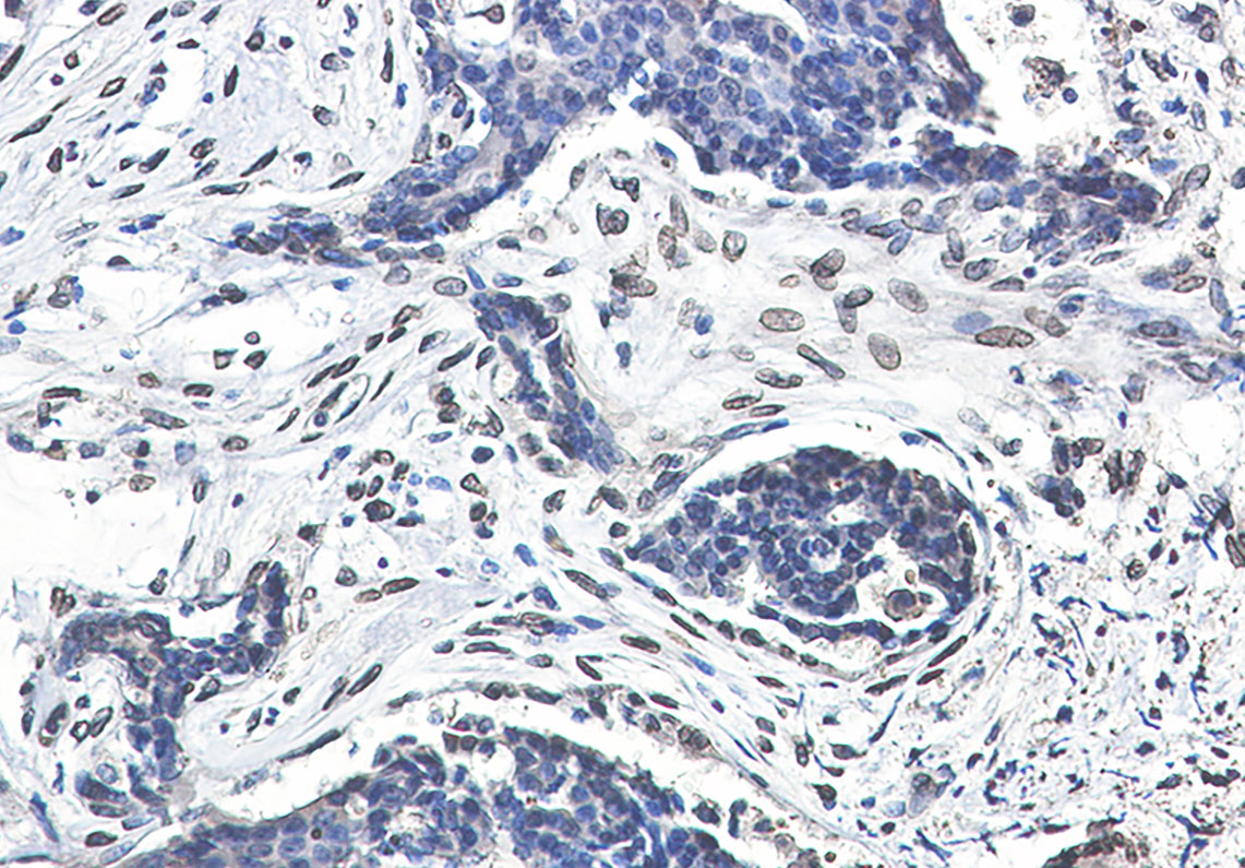 Lamin A/C Rabbit mAb