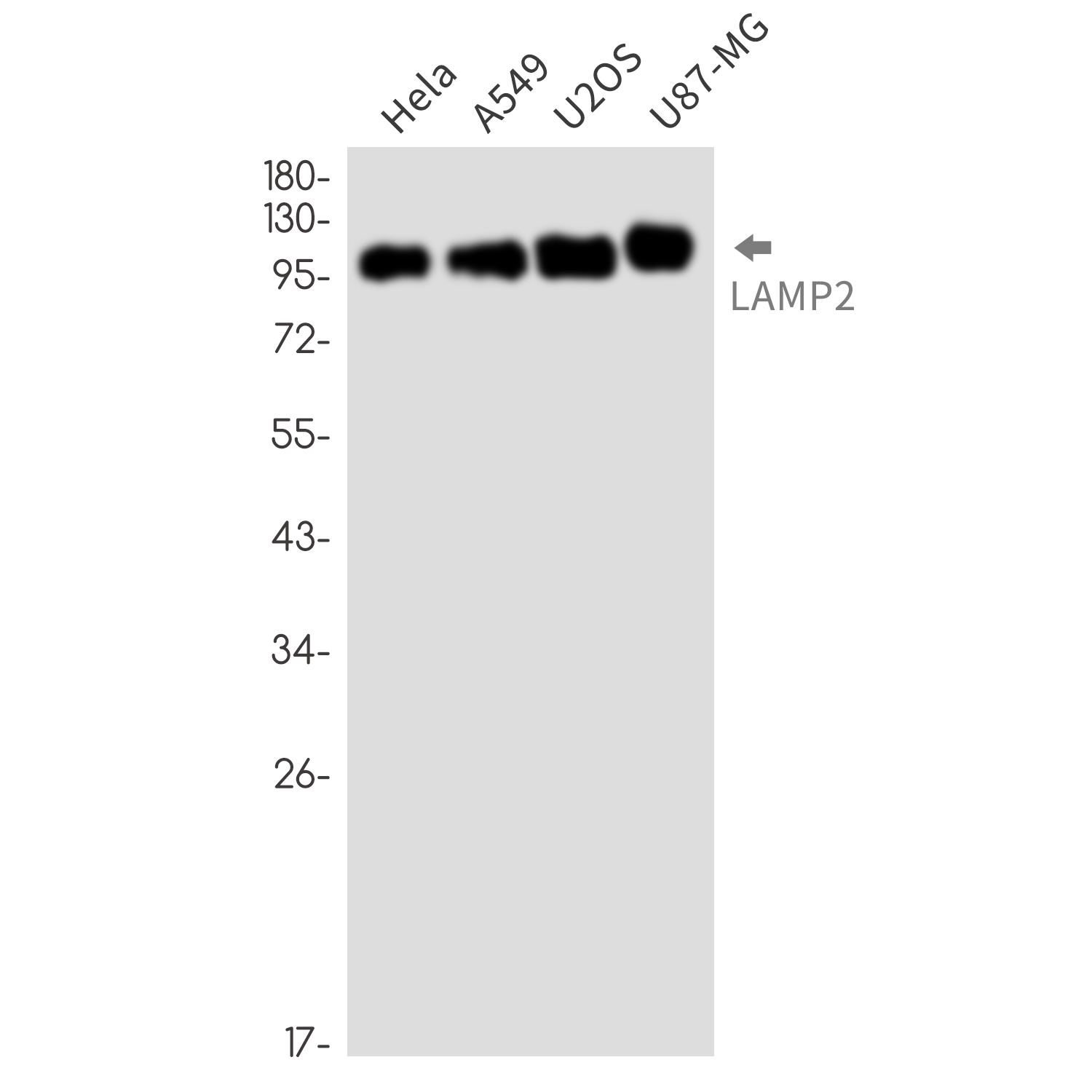 LAMP2 Rabbit mAb