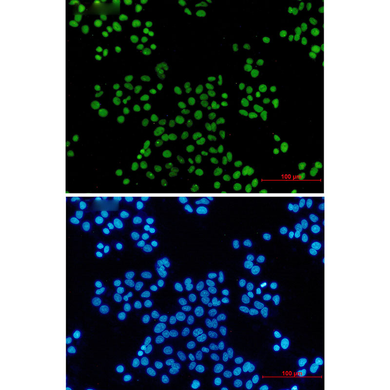 MCM2 Rabbit mAb