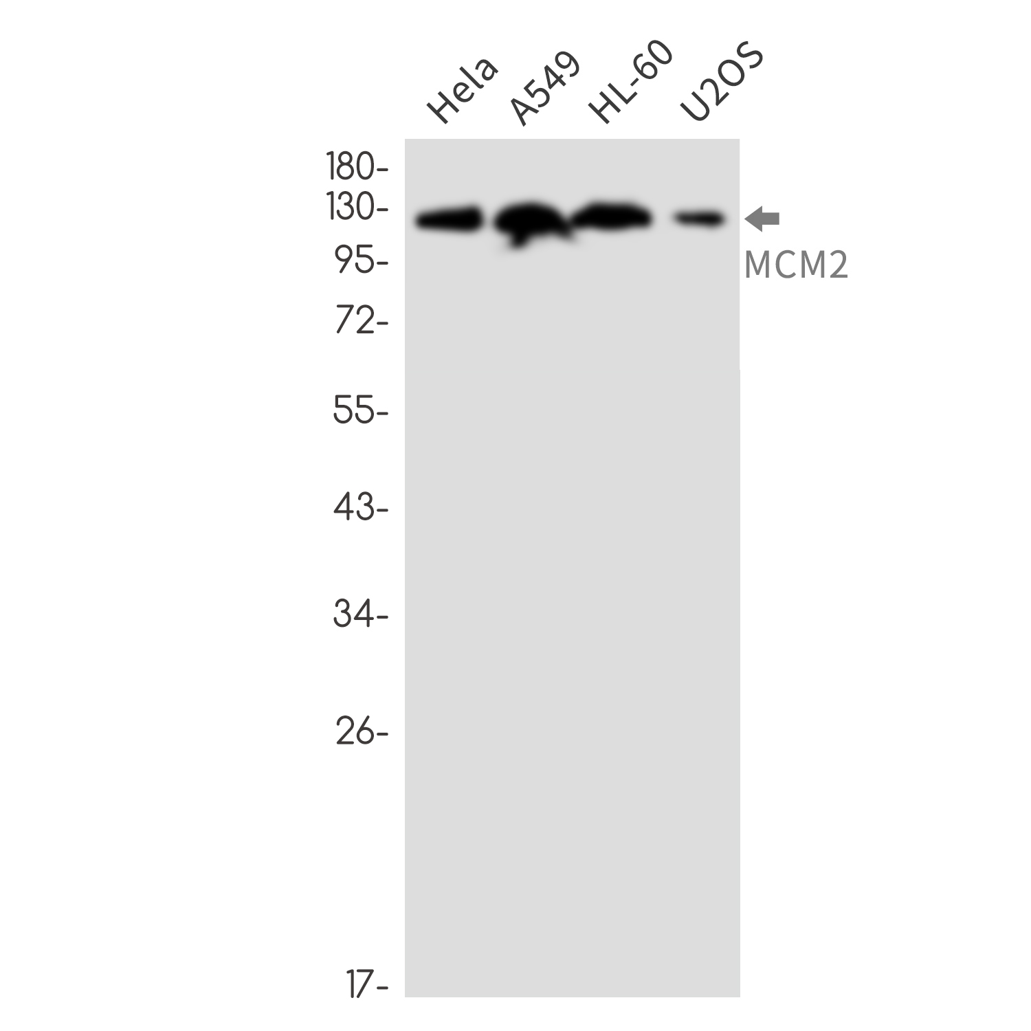 MCM2 Rabbit mAb