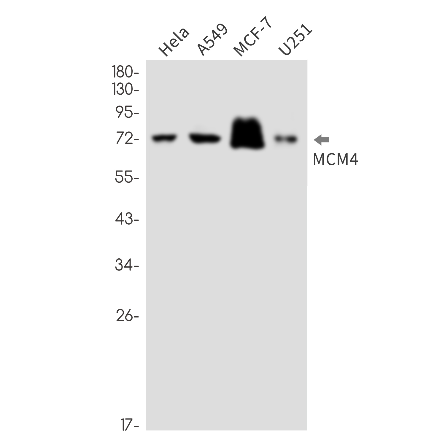 MCM4 Rabbit mAb