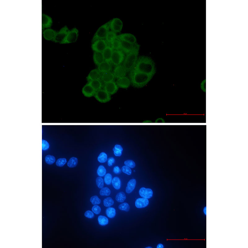 MEK2 Rabbit mAb