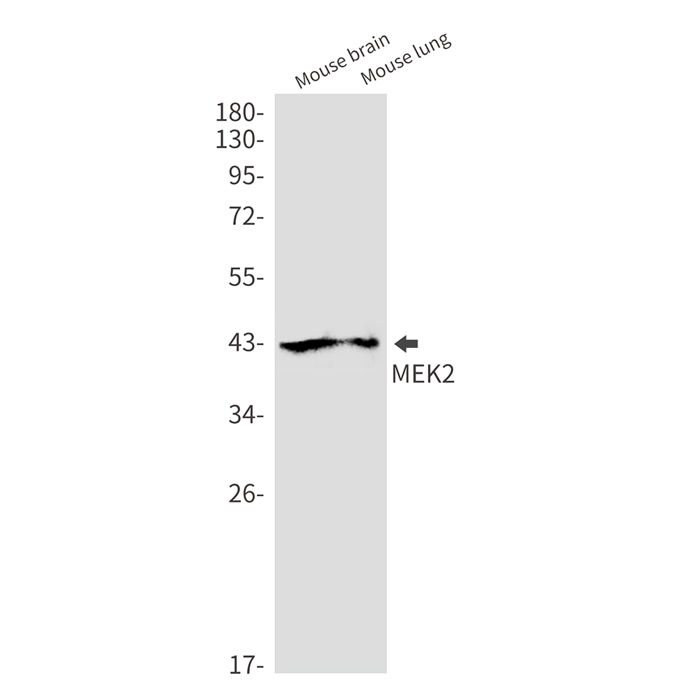 MEK2 Rabbit mAb