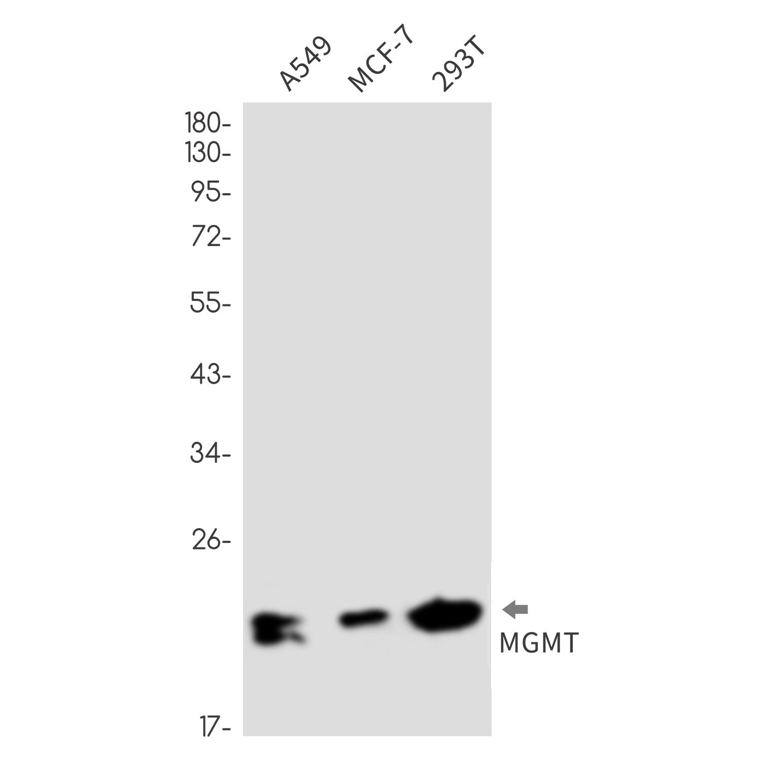 MGMT Rabbit mAb