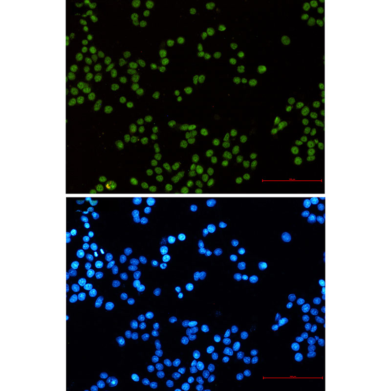 MLH1 Rabbit mAb