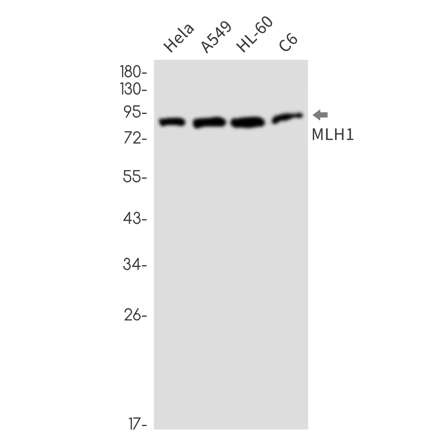 MLH1 Rabbit mAb