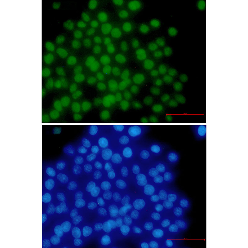 MSH6 Rabbit mAb