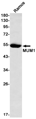 Interferon Regulatory Factor 4 Rabbit mAb