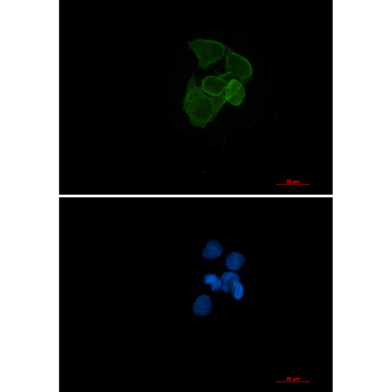 alpha Skeletal Muscle Actin Rabbit mAb