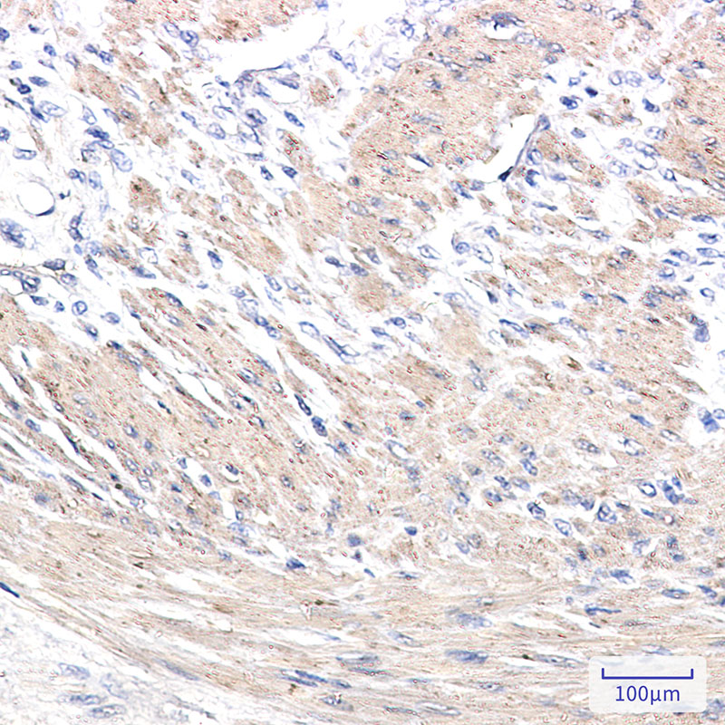 alpha Skeletal Muscle Actin Rabbit mAb