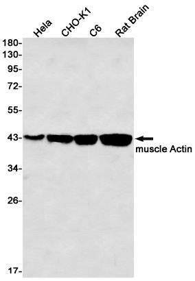 alpha Skeletal Muscle Actin Rabbit mAb