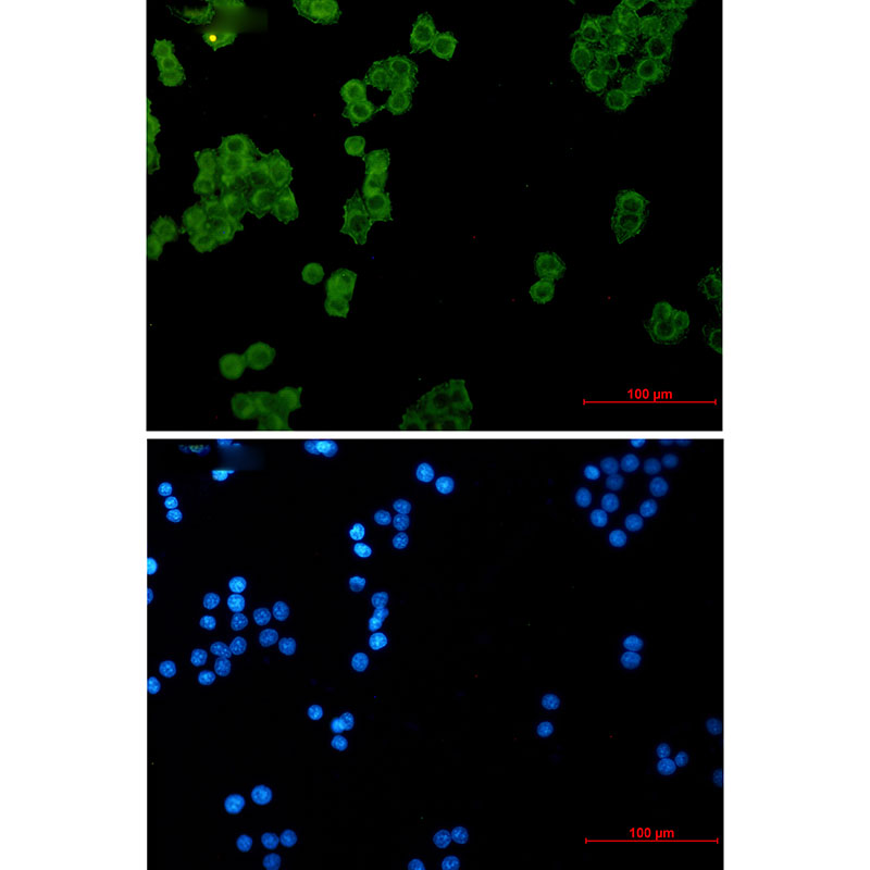 NDUFS1 Rabbit mAb