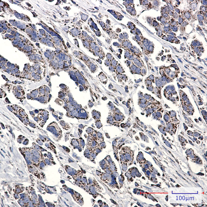 NDUFS1 Rabbit mAb