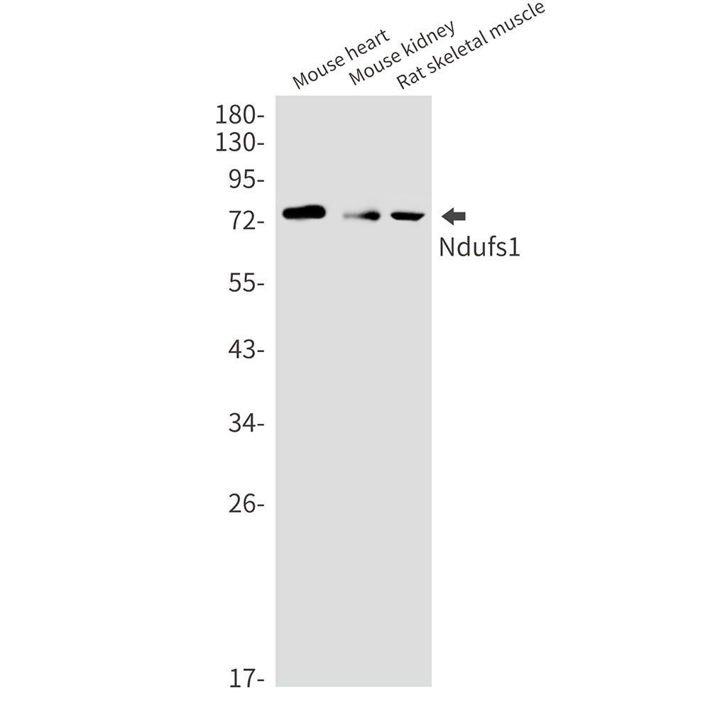 NDUFS1 Rabbit mAb