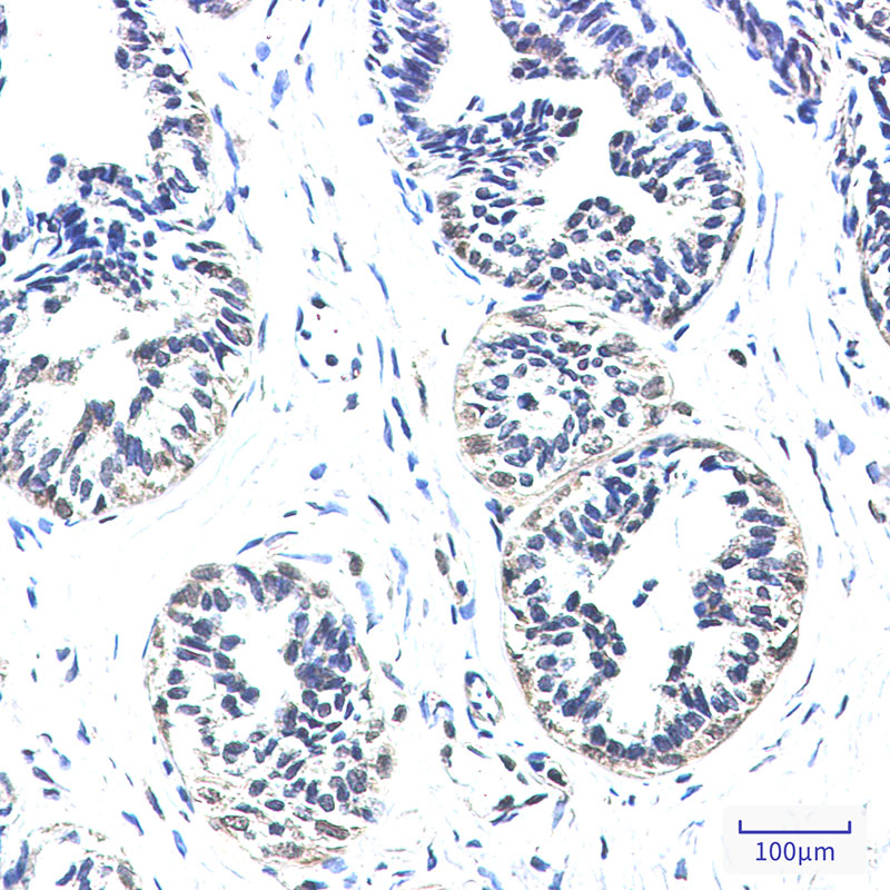 NDUFS2 Rabbit mAb