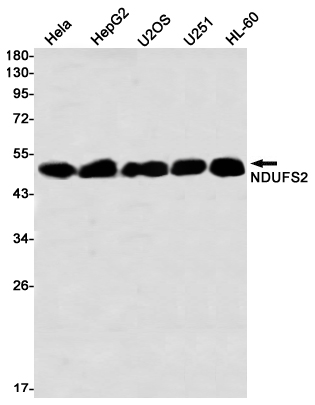 NDUFS2 Rabbit mAb