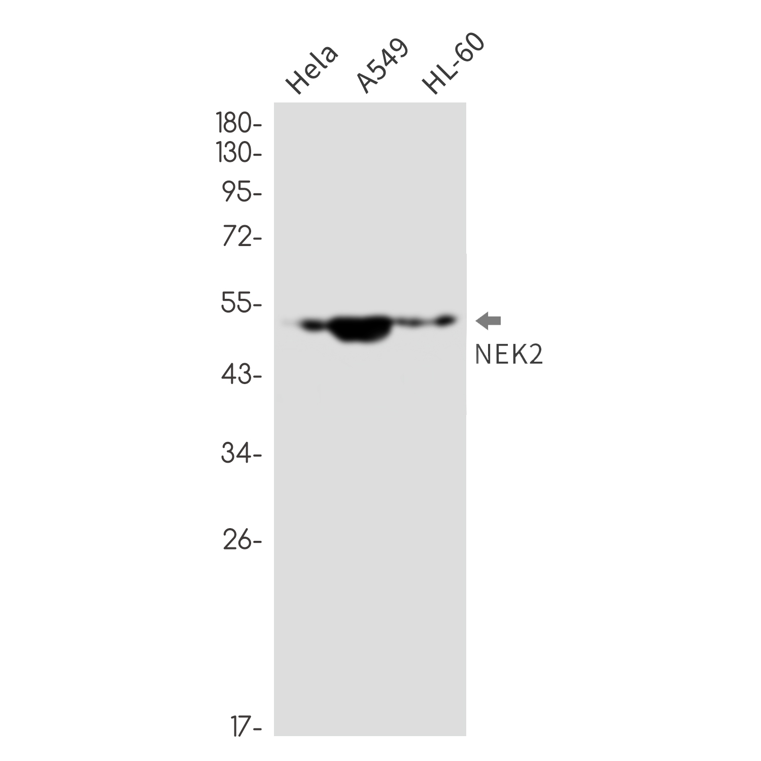 NEK2 Rabbit mAb