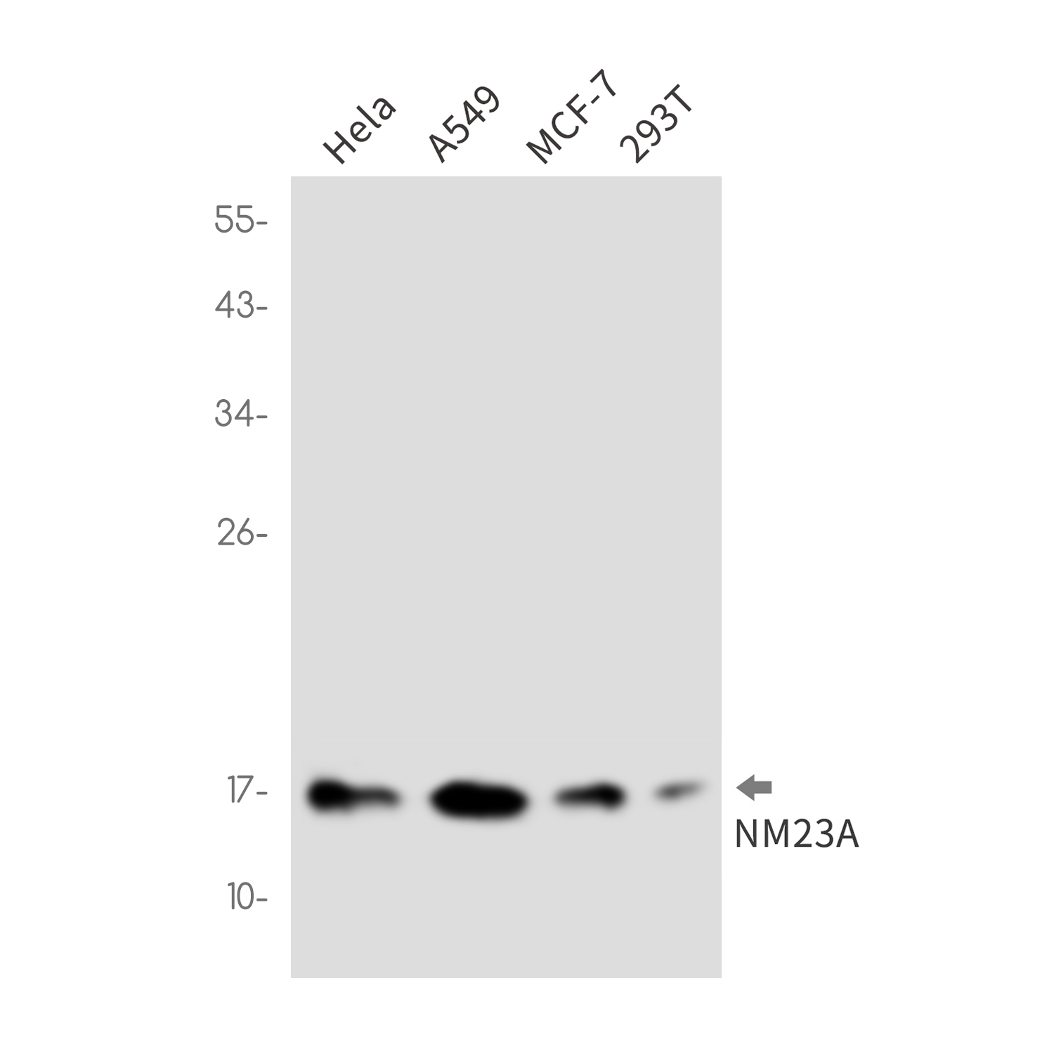 NM23A Rabbit mAb