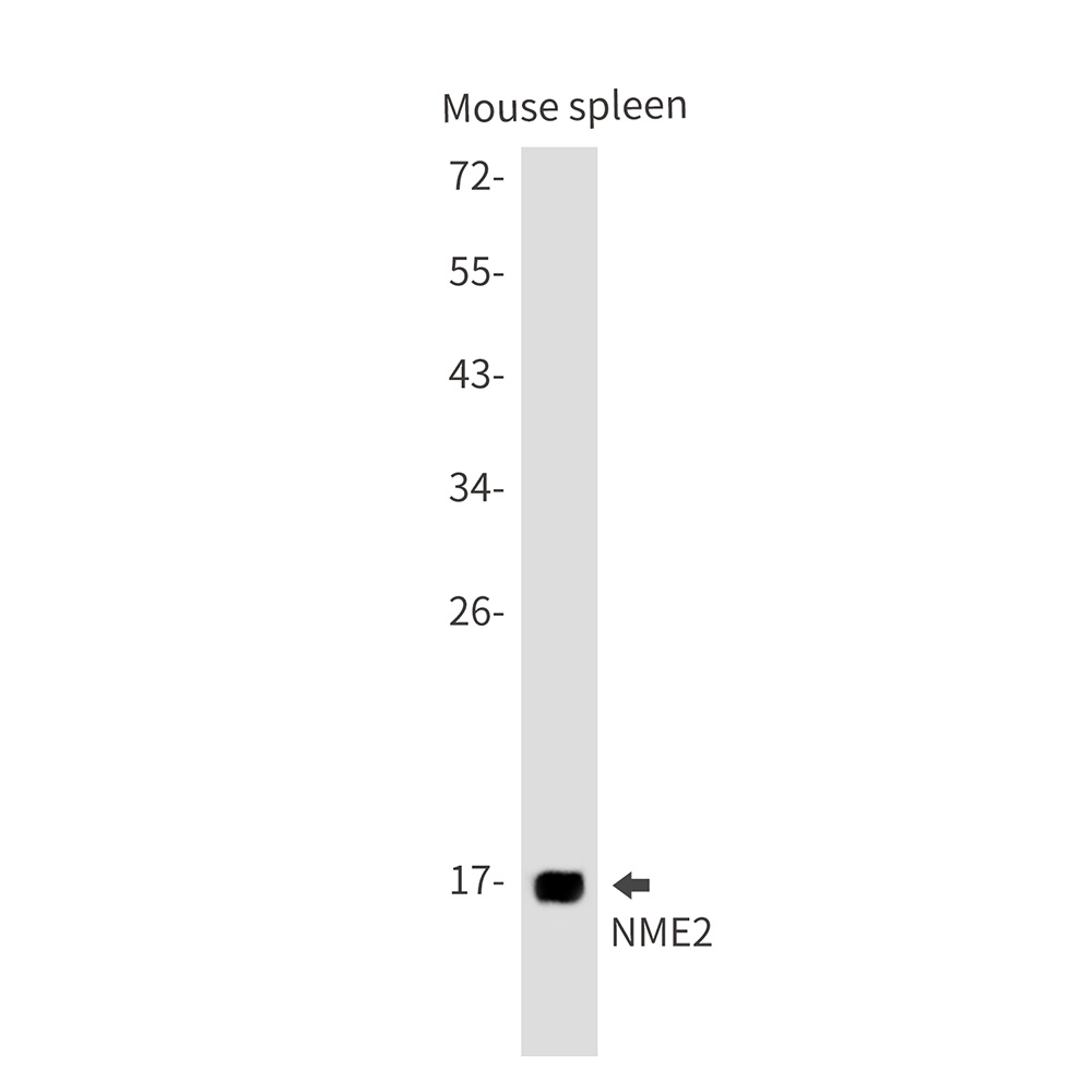 NME2 Rabbit mAb