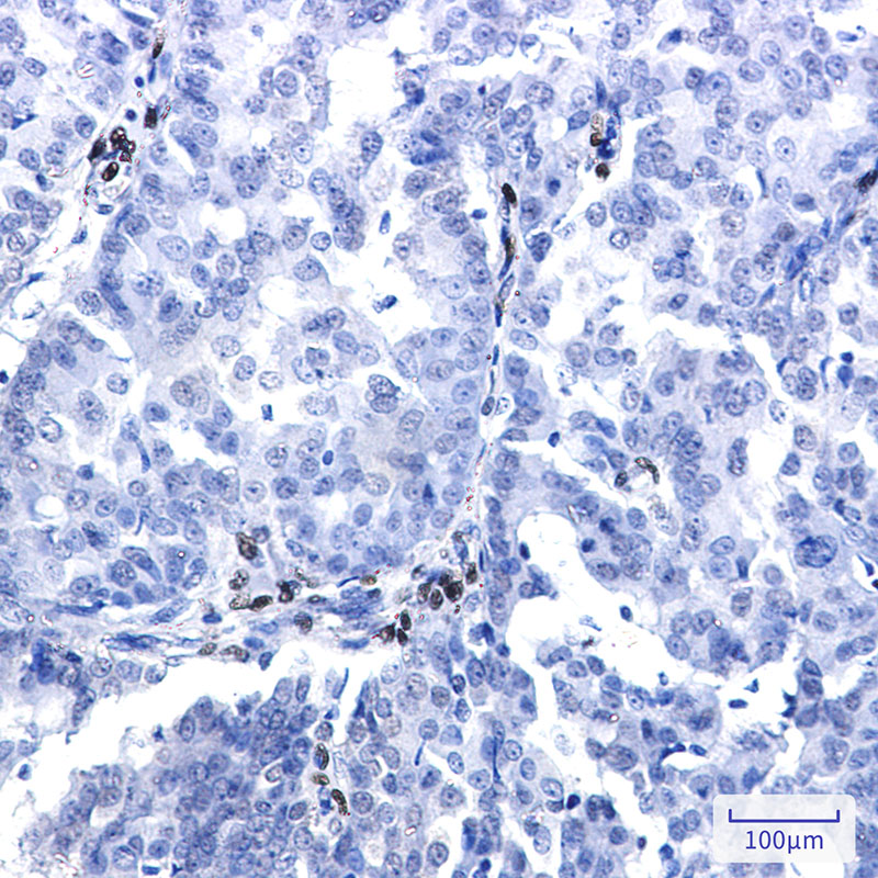 NR2F2 Rabbit mAb