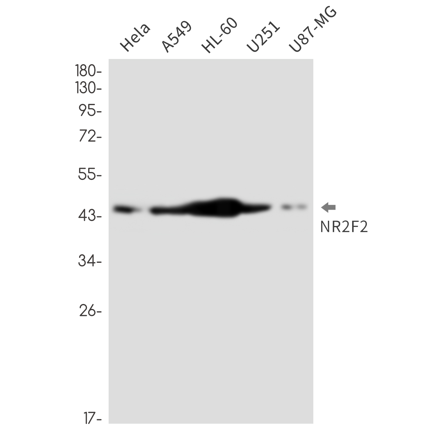 NR2F2 Rabbit mAb