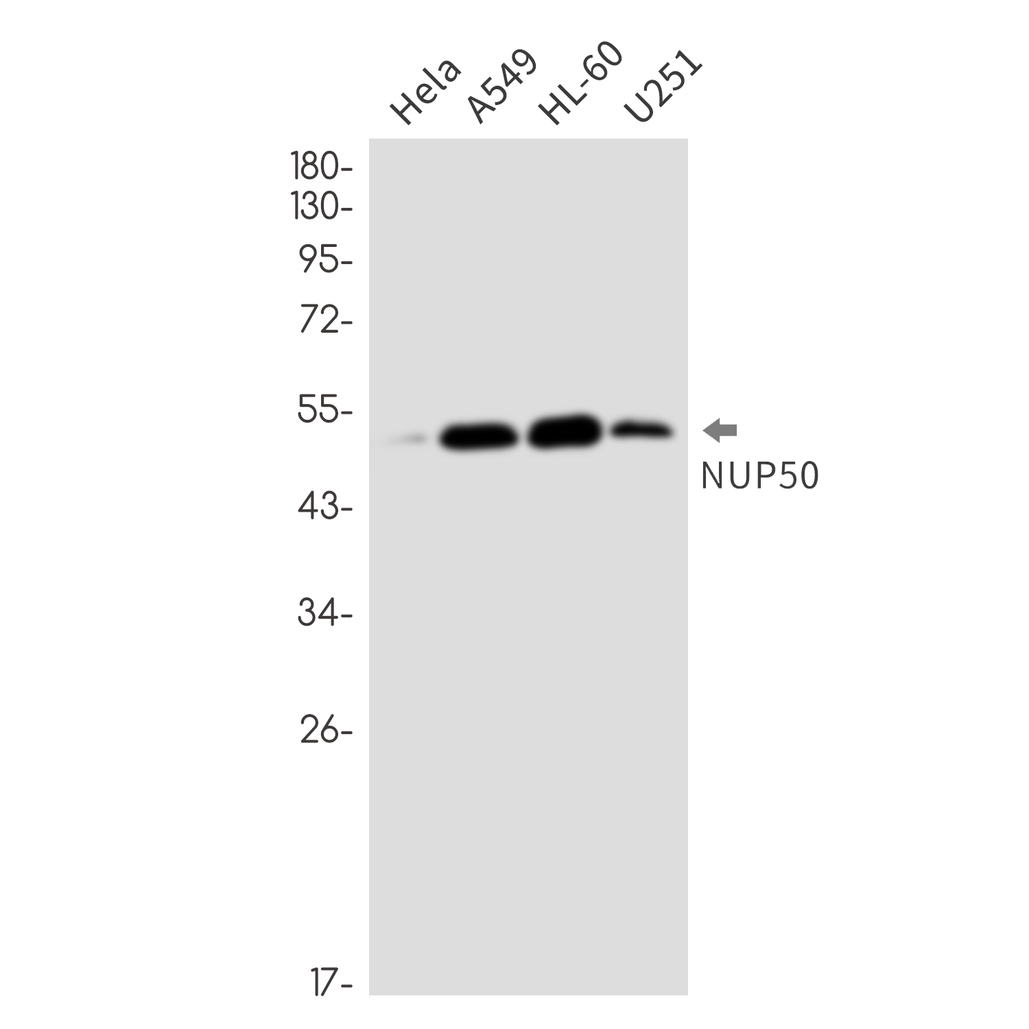 NUP50 Rabbit mAb