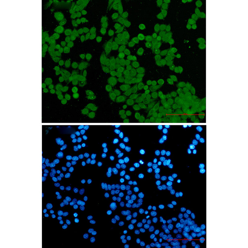 NUP50 Rabbit mAb