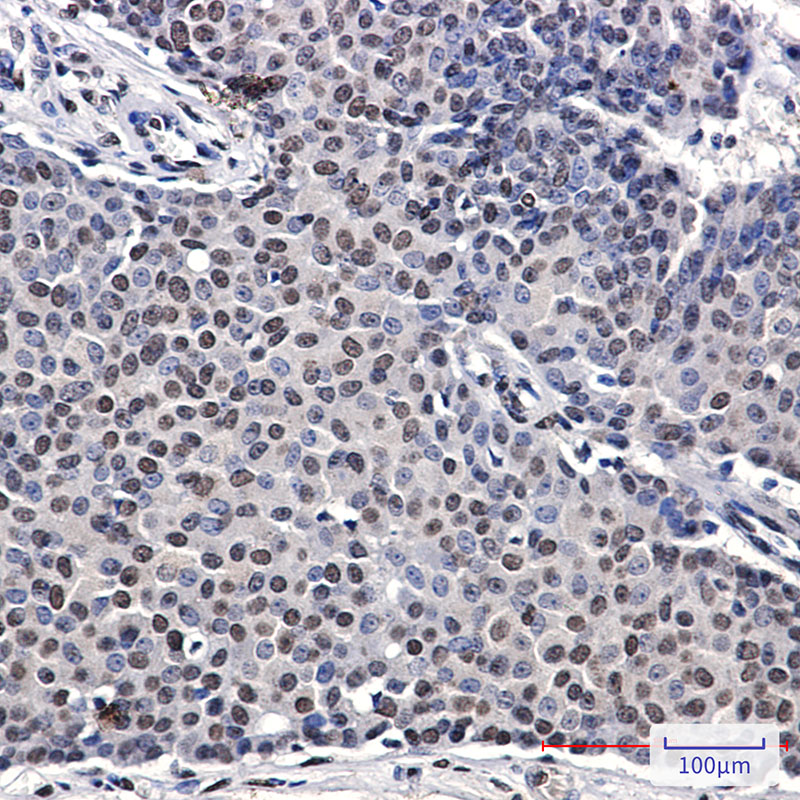 p57 Kip2 Rabbit mAb