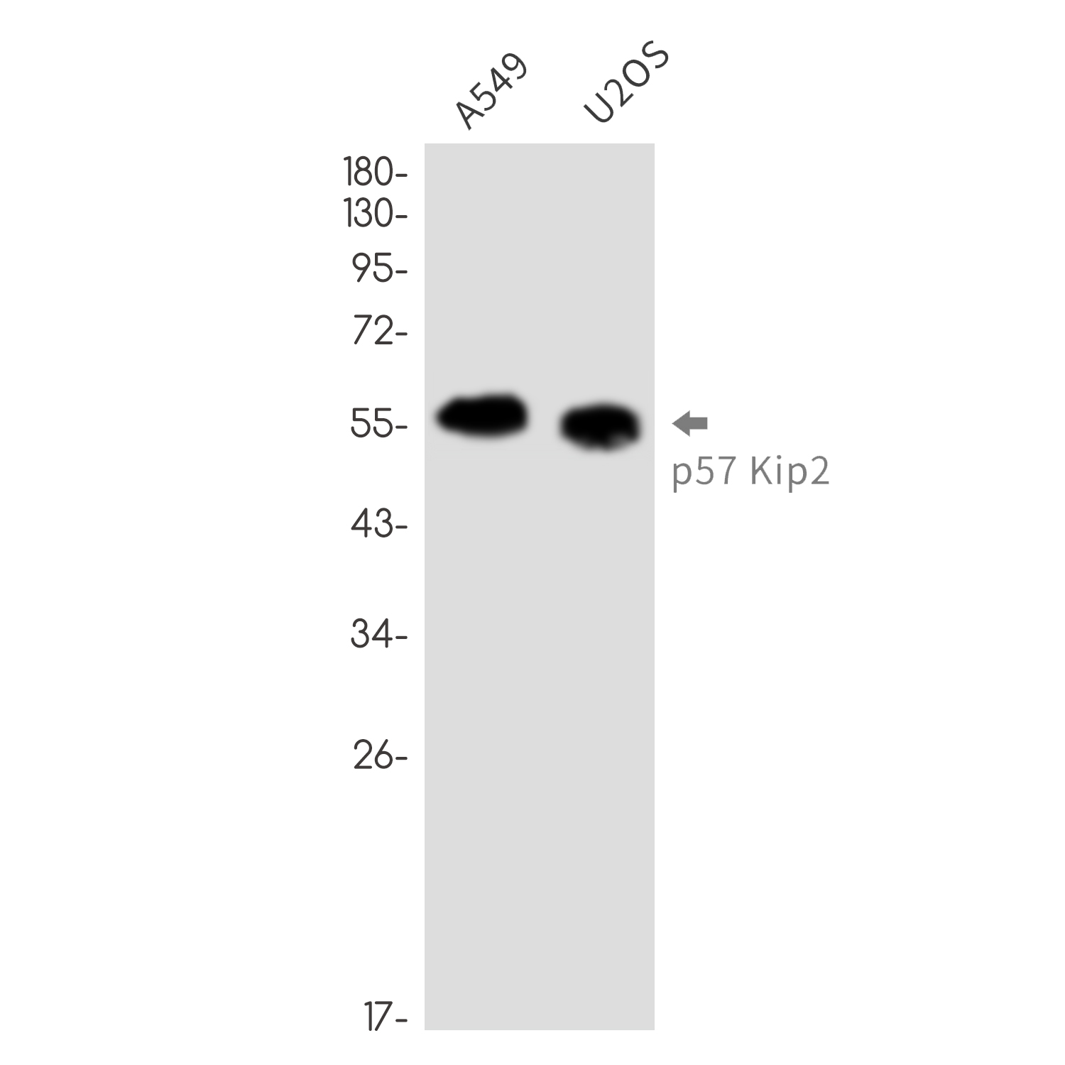 p57 Kip2 Rabbit mAb