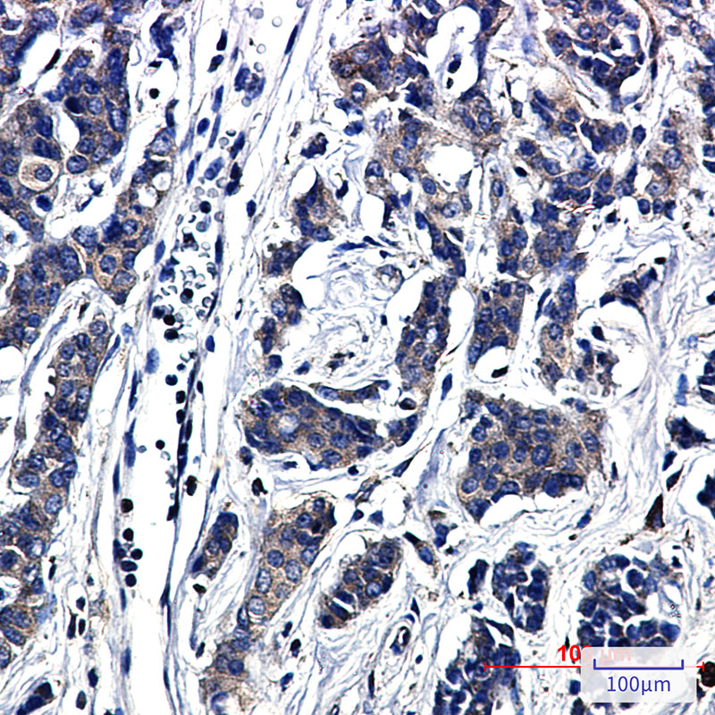 Paxillin Rabbit mAb