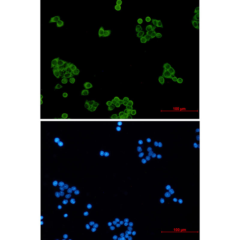 Peroxiredoxin 1 Rabbit mAb