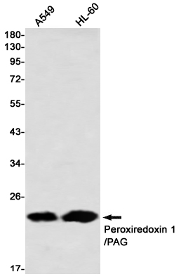 Peroxiredoxin 1 Rabbit mAb