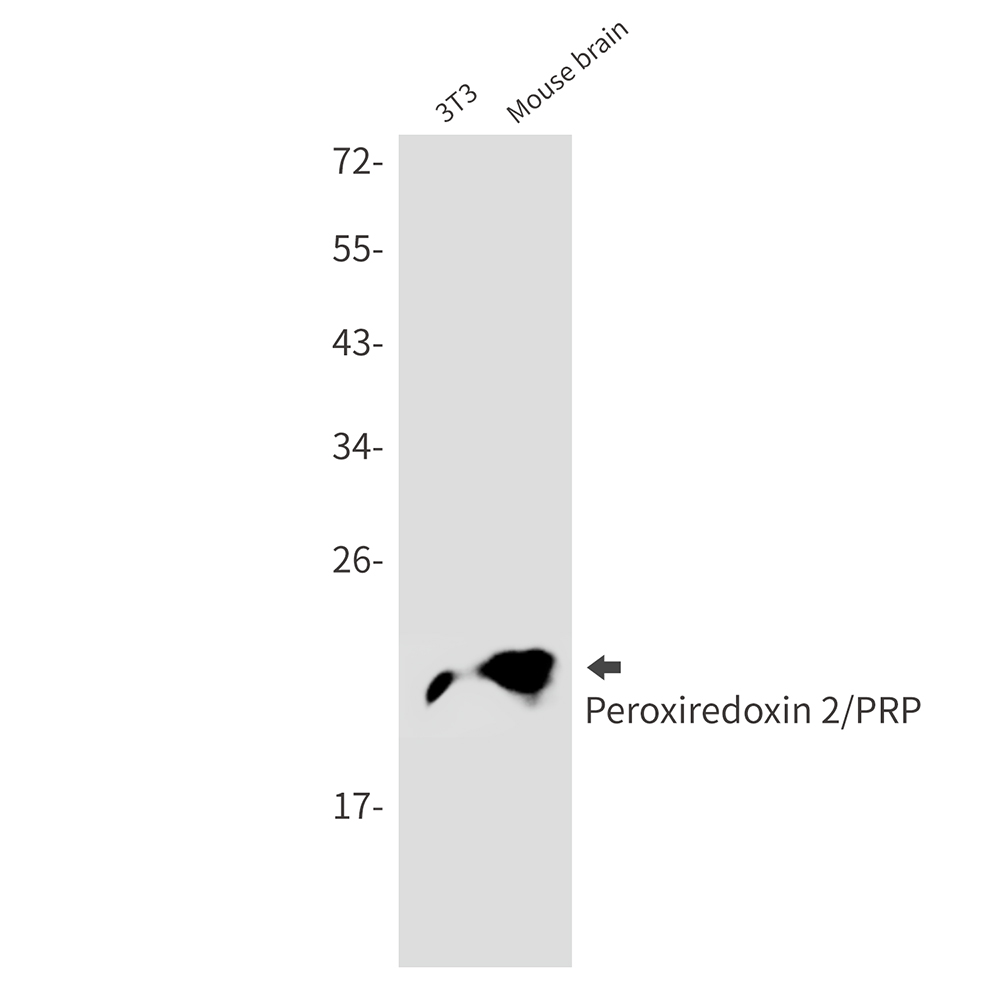 Peroxiredoxin 2 Rabbit mAb